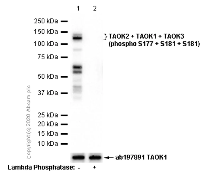 Western blot - Anti-TAOK2 + TAOK1 + TAOK3 (phospho S177 + S181 + S181) antibody [EPR4883] (AB124841)