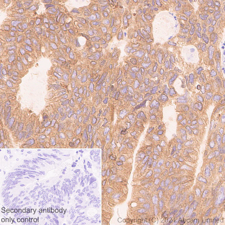 Immunohistochemistry (Formalin/PFA-fixed paraffin-embedded sections) - Anti-TAP1 antibody [EPR26236-92] (AB322039)