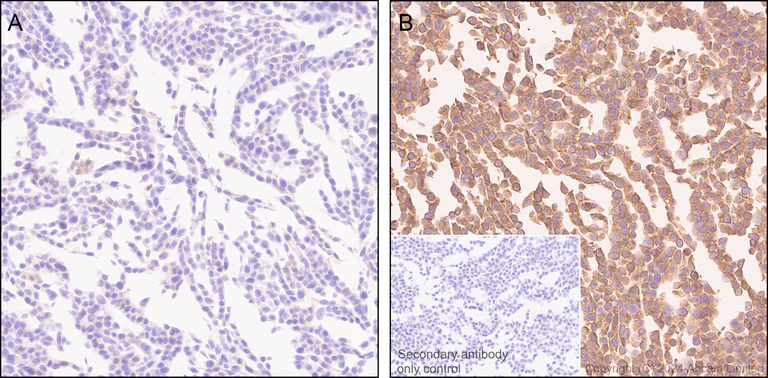 Immunohistochemistry (Formalin/PFA-fixed paraffin-embedded sections) - Anti-TAP1 antibody [EPR26236-92] - BSA and Azide free (AB322040)