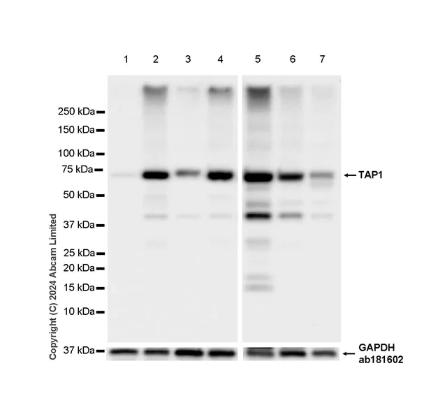 Western blot - Anti-TAP1 antibody [EPR26236-92] - BSA and Azide free (AB322040)