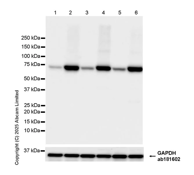 Western blot - Anti-TAP1 antibody [EPR30551-512] (AB324718)