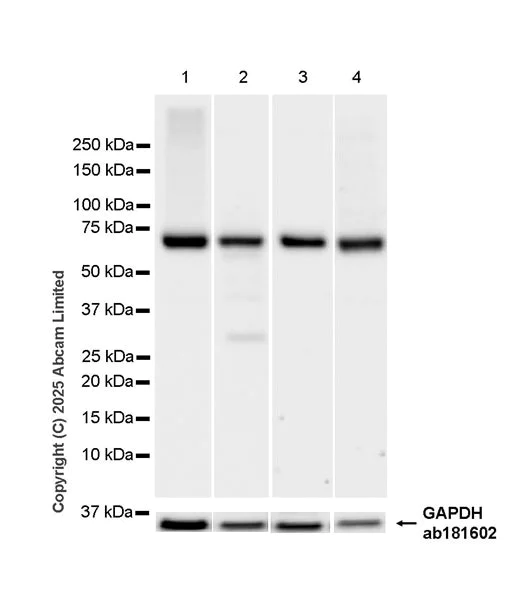 Western blot - Anti-TAP1 antibody [EPR30551-512] - BSA and Azide free (AB324720)