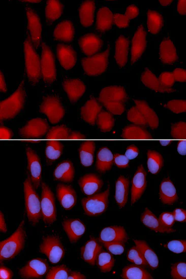 Immunocytochemistry/ Immunofluorescence - Anti-TAP2 antibody (AB180611)