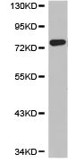 Western blot - Anti-TAP2 antibody (AB180611)