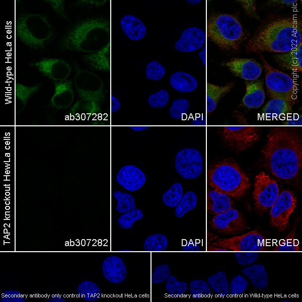 Immunocytochemistry/ Immunofluorescence - Anti-TAP2 antibody [EPR26237-82] (ab307282), expandable thumbnail