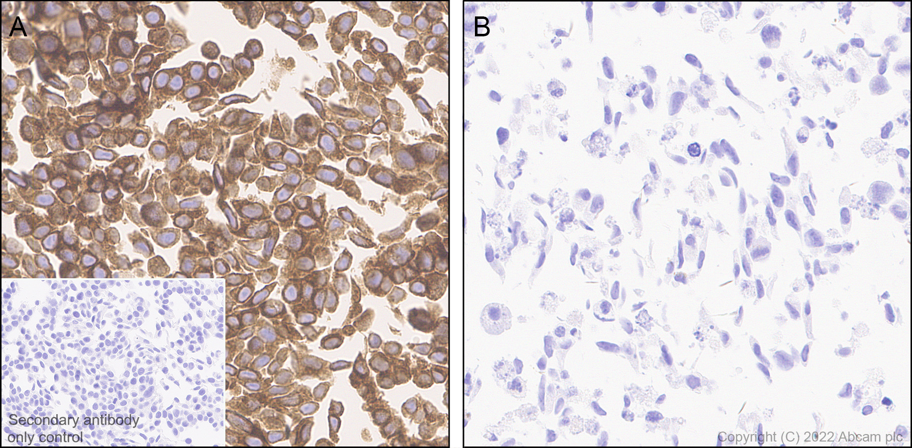 Immunohistochemistry - Anti-TAP2 antibody [EPR26237-82] (ab307282), expandable thumbnail