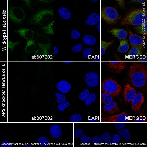 Immunocytochemistry/ Immunofluorescence - Anti-TAP2 antibody [EPR26237-82] - BSA and Azide free (AB307283)