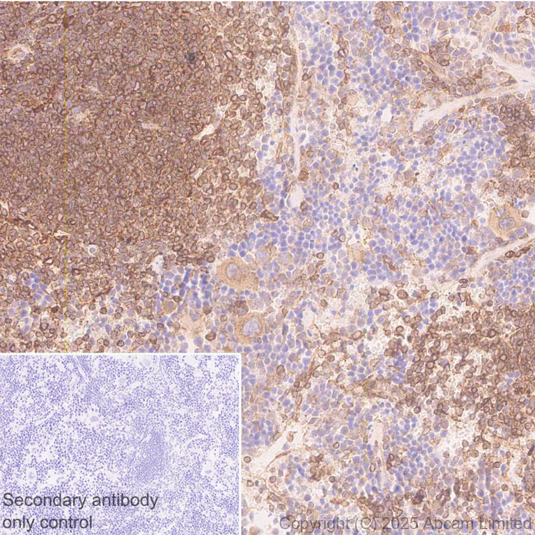 Immunohistochemistry (Formalin/PFA-fixed paraffin-embedded sections) - Anti-TAP2 antibody [EPR30552-571] (AB324348)