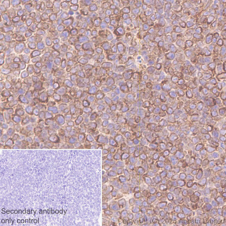 Immunohistochemistry (Formalin/PFA-fixed paraffin-embedded sections) - Anti-TAP2 antibody [EPR30552-571] - BSA and Azide free (AB324358)