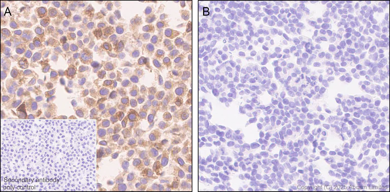 Immunohistochemistry (Formalin/PFA-fixed paraffin-embedded sections) - Anti-TAP2 antibody [EPR30552-571] - BSA and Azide free (AB324358)