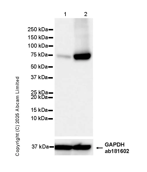 Western blot - Anti-TAP2 antibody [EPR30552-571] - BSA and Azide free (AB324358)