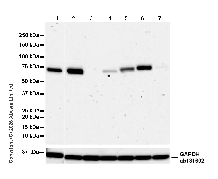 Western blot - Anti-TAP2 antibody [EPR30552-571] - BSA and Azide free (AB324358)