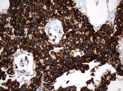 Immunohistochemistry (Formalin/PFA-fixed paraffin-embedded sections) - Anti-TAPBP-R antibody [OTI1C9] (AB236419), expandable thumbnail