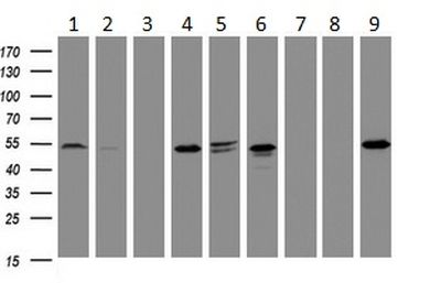 Western blot - Anti-TAPBP-R antibody [OTI1C9] (AB236419), expandable thumbnail