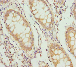 Immunohistochemistry (Formalin/PFA-fixed paraffin-embedded sections) - Anti-TAPP-1 antibody (AB230181)