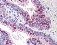 Immunohistochemistry (Formalin/PFA-fixed paraffin-embedded sections) - Anti-TARBP1 antibody (AB115896)