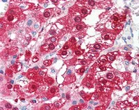 Immunohistochemistry (Formalin/PFA-fixed paraffin-embedded sections) - Anti-TARBP1 antibody (AB115896)