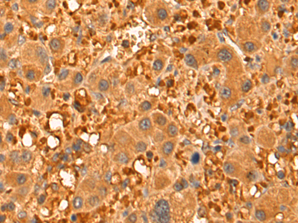 Anti-TARC/CCL17 antibody