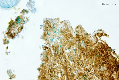 Immunohistochemistry (Formalin/PFA-fixed paraffin-embedded sections) - Anti-TARC/CCL17 antibody (AB182793)