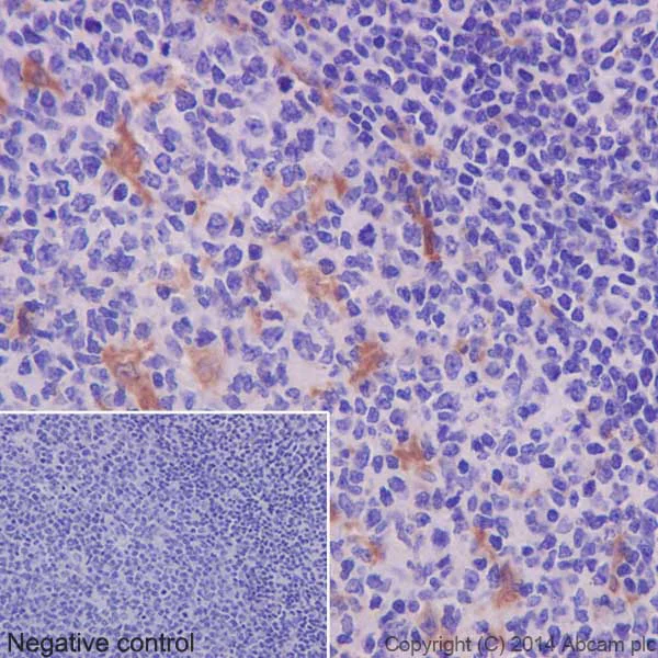Immunohistochemistry (Formalin/PFA-fixed paraffin-embedded sections) - Anti-TARC/CCL17 antibody [EPR15861] (AB195044)