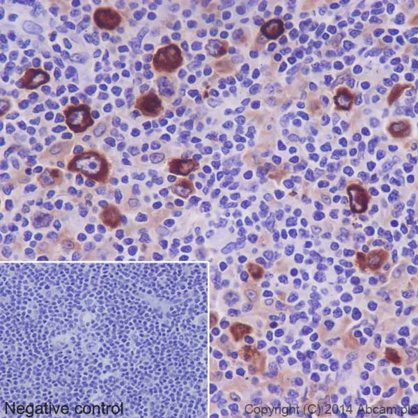 Immunohistochemistry (Formalin/PFA-fixed paraffin-embedded sections) - Anti-TARC/CCL17 antibody [EPR15861] (AB195044)