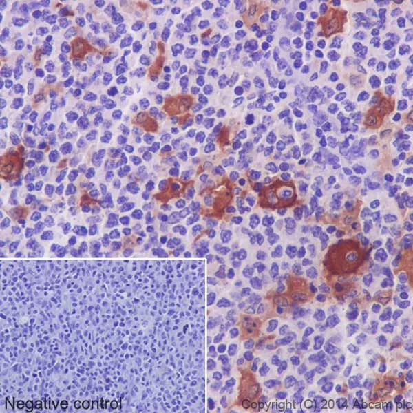 Immunohistochemistry (Formalin/PFA-fixed paraffin-embedded sections) - Anti-TARC/CCL17 antibody [EPR15861] (AB195044)