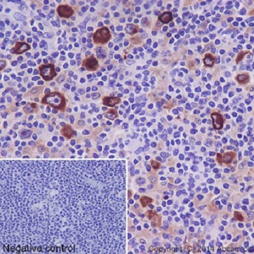 Immunohistochemistry (Formalin/PFA-fixed paraffin-embedded sections) - Anti-TARC/CCL17 antibody [EPR15861] - BSA and Azide free (AB232659)