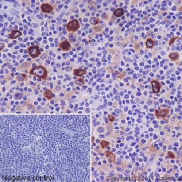 Immunohistochemistry (Formalin/PFA-fixed paraffin-embedded sections) - Anti-TARC/CCL17 antibody [EPR15861] - BSA and Azide free (AB232659)