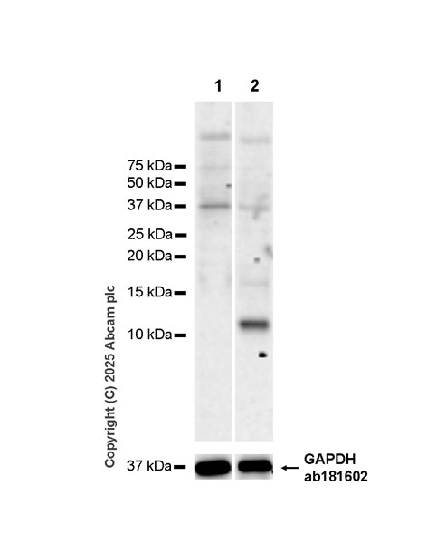 Western blot - Anti-TARC/CCL17 antibody [EPR28961-9] (AB323800), expandable thumbnail