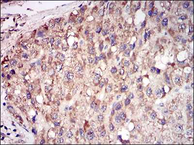 Immunohistochemistry (Formalin/PFA-fixed paraffin-embedded sections) - Anti-Tartrate Resistant Acid Phosphatase antibody [7E6A11] (AB181468)