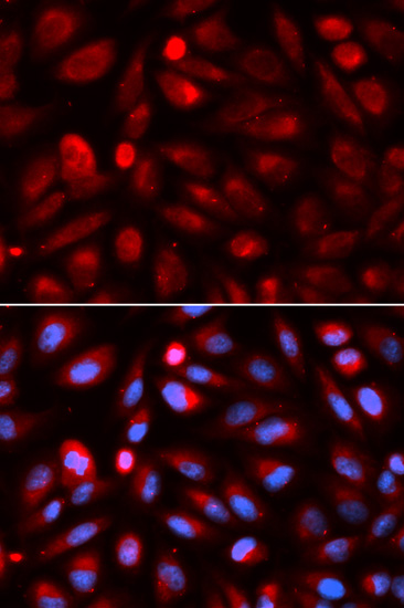 Immunocytochemistry/ Immunofluorescence - Anti-Tartrate Resistant Acid Phosphatase antibody (AB185716)