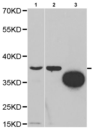Western blot - Anti-Tartrate Resistant Acid Phosphatase antibody (AB185716)