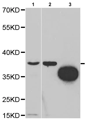 Western blot - Anti-Tartrate Resistant Acid Phosphatase antibody (AB185716)