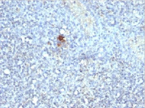 Immunohistochemistry (Formalin/PFA-fixed paraffin-embedded sections) - Anti-Tartrate Resistant Acid Phosphatase antibody [ACP5/1070] (AB216025)
