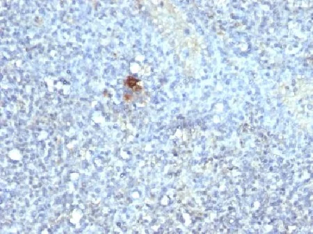 Immunohistochemistry (Formalin/PFA-fixed paraffin-embedded sections) - Anti-Tartrate Resistant Acid Phosphatase antibody [ACP5/1070] - BSA and Azide free (AB212723)