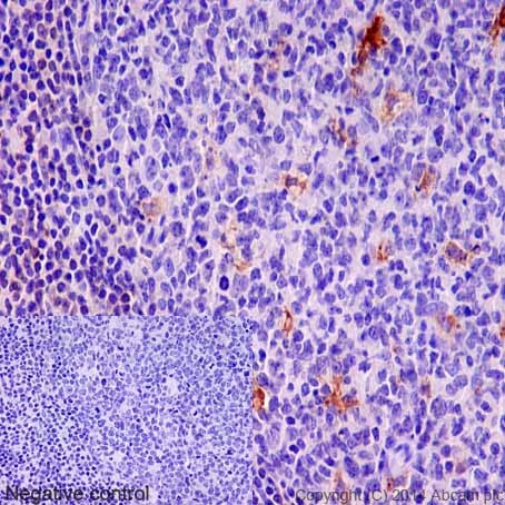 Immunohistochemistry (Formalin/PFA-fixed paraffin-embedded sections) - Anti-Tartrate Resistant Acid Phosphatase antibody [EPR15556] (AB191406)