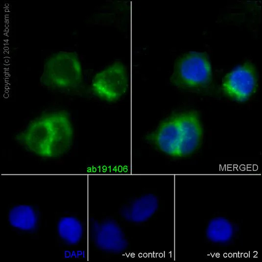 Immunocytochemistry/ Immunofluorescence - Anti-Tartrate Resistant Acid Phosphatase antibody [EPR15556] - BSA and Azide free (AB240970)