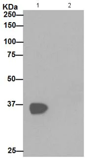 Immunoprecipitation - Anti-Tartrate Resistant Acid Phosphatase antibody [EPR15556] - BSA and Azide free (AB240970)