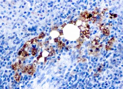 Immunohistochemistry (Formalin/PFA-fixed paraffin-embedded sections) - Anti-Tartrate Resistant Acid Phosphatase antibody [rACP5/1070] - BSA and Azide free (AB237879), expandable thumbnail