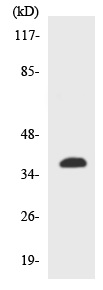 Western blot - Anti-TAS2R14 antibody (AB138271), expandable thumbnail