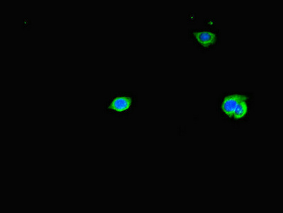 Immunocytochemistry/ Immunofluorescence - Anti-TAS2R38 antibody (AB222859), expandable thumbnail
