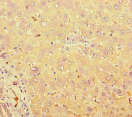 Immunohistochemistry (Formalin/PFA-fixed paraffin-embedded sections) - Anti-TAS2R38 antibody (AB222859), expandable thumbnail