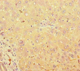 Immunohistochemistry (Formalin/PFA-fixed paraffin-embedded sections) - Anti-TAS2R38 antibody (AB222859)