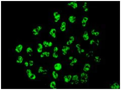 Immunocytochemistry/ Immunofluorescence - Anti-Tat-SF1 antibody [EPR9104(B)] (AB140654)