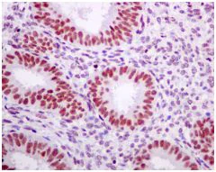 Immunohistochemistry (Formalin/PFA-fixed paraffin-embedded sections) - Anti-Tat-SF1 antibody [EPR9104(B)] (AB140654)