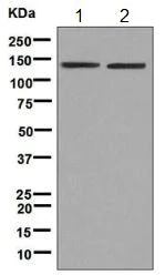 Western blot - Anti-Tat-SF1 antibody [EPR9104(B)] (AB140654)