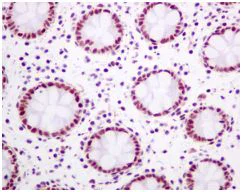 Immunohistochemistry (Formalin/PFA-fixed paraffin-embedded sections) - Anti-Tat-SF1 antibody [EPR9104(B)] - BSA and Azide free (AB248932)