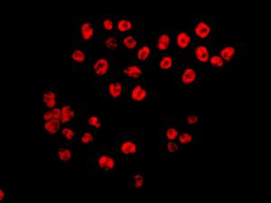 Immunocytochemistry/ Immunofluorescence - Anti-Tat-SF1 antibody [EPR9105(B)] (AB134921), expandable thumbnail