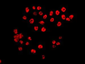 Immunocytochemistry/ Immunofluorescence - Anti-Tat-SF1 antibody [EPR9105(B)] (AB134921)