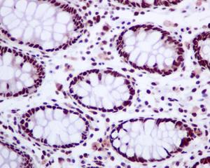 Immunohistochemistry (Formalin/PFA-fixed paraffin-embedded sections) - Anti-Tat-SF1 antibody [EPR9105(B)] (AB134921), expandable thumbnail